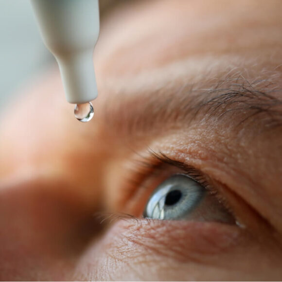 Man applying eye-drops